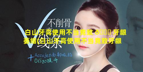 白山牙膏使用不当竟致 💐 牙龈萎缩(白山牙膏使用不当竟致牙龈萎缩怎 🌳 么办)